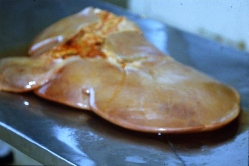 Genetic Regulation of Fatty Liver Disease in Dairy Cows