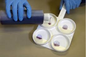 On-Farm and Laboratory Diagnostics for Bovine Mastitis