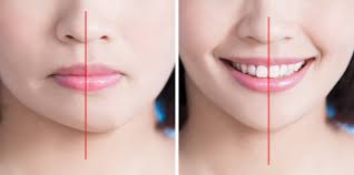 Growth & Facial Asymmetry: When to Worry