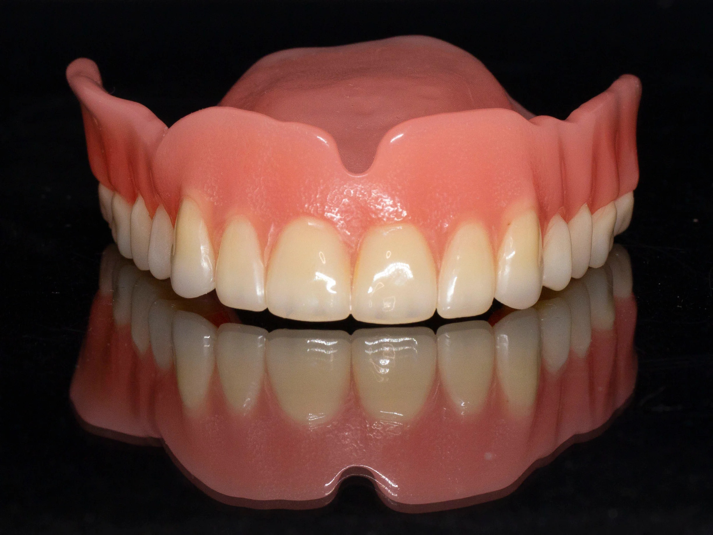 Designing Cast Partial Dentures for Predictable, Long-Term Success
